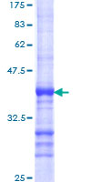 12.5% SDS-PAGE Stained with Coomassie Blue.